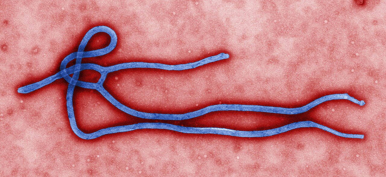 Nigeria Confirms Ebola Case in Abuja, Starts Tracing 44 Contacts